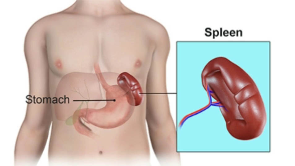 Spleen surgery